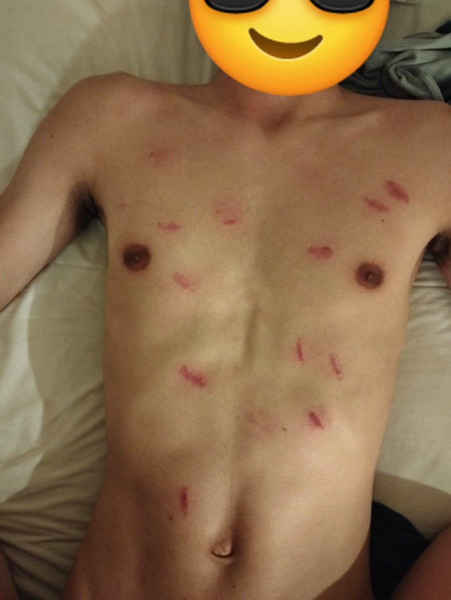 Legaaaaaa game💦💦💦💦💦 2 Round Dulu Rest Sambung kul 11.45 sampi 5pg...Bott dah pedih koyak sikit, penuh mani Lobang bott 💦💦🥰