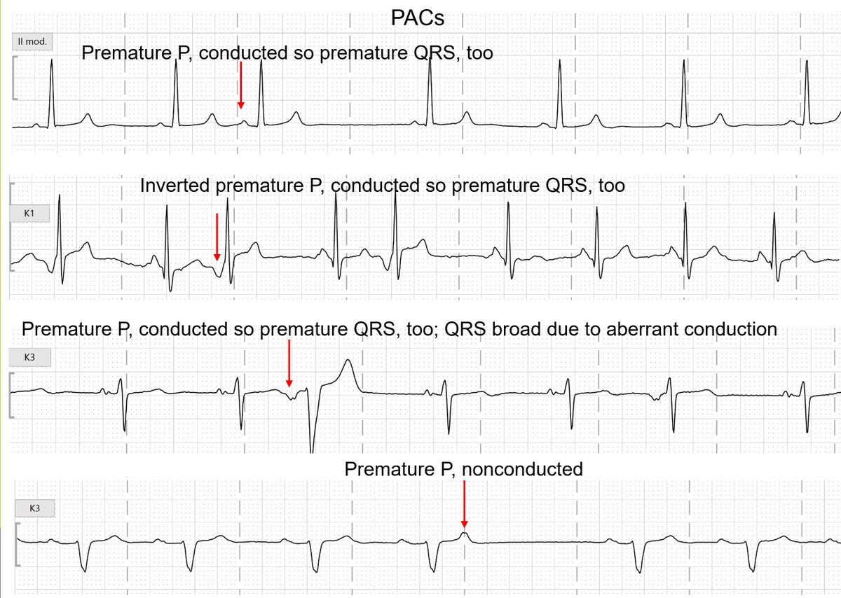 What you should know about PACs👇