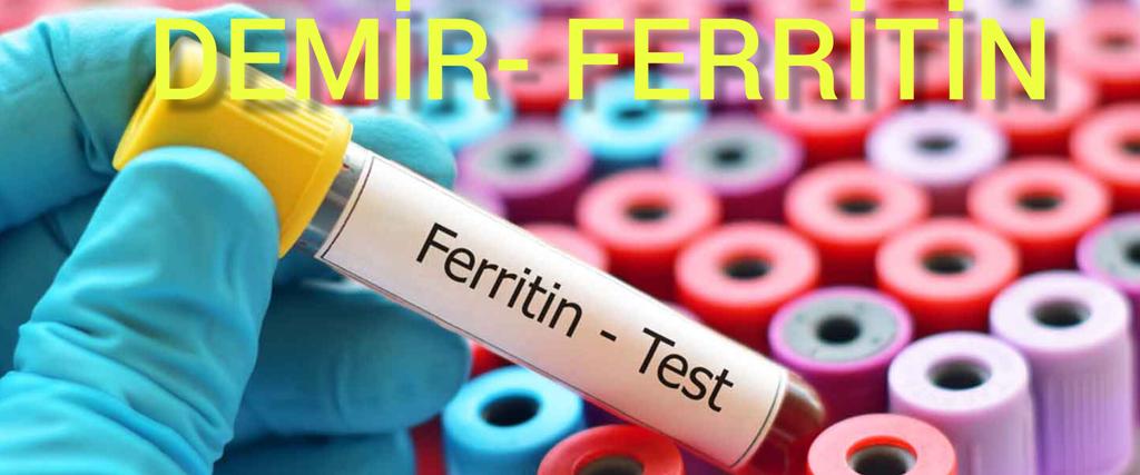 TraderAT12's tweet photo. 🔴 #demir #ferritin #bakteri #virus
🩸Grip, covid, soğuk algınlığı varken Demir takviyesi neden KULLANIL-MA-MA-LI

🩸Demir emilimi neden olmaz ? Çay, kahve,kalsiyum,fitatlar nasıl ve HANGİ DEMIRE engel olur...

🩸Bitkisel kaynaklı mı? Hayvansal kaynaklı demir mi önemli?

🩸Ferritin yuksek olduğu halde demir neden düşer ?

🩸Neden Multi viraminlerde demir OLMA-MA-LI

⚪️DEMIR : 
💧Canlı için olmazsa olmaz bir mineral
📍Oksijen taşınması
📍Tiroit fonksiyonları
📍Serotonin, melatonin sentezi
📍Karacegirde detoksifikasyon
Bir sürü islevi var.. 

💧Gidalarla Bagirsaklara iki çeşit demir gider... +² ve +³ degerlikli..

💧Hayvansal olanlar +² degerlikli olanlar..Bunlar etin icinde ki hemoglobin ve miyoglobinden alırız (hem demir) 

💧+³ degerlikli olanlar bitkisel kaynaklı...Baklagiller, hububatlar, ıspanak, üzüm, pekmez vs....(Non-hem)

🚫Bagirsaklar Bitkisel kaynakli demirin sadece %4 civarını emer..
📍Yani ıspanak ye temel reis ol, pekmez iç kanın yükselsin konusu afaki soylemler...

🩸Çay, kahve, kalsiyum, baklagillerde ki fitatlar BİTKİSEL KAYNAKLI demir emilimini ENGELLER....

🩸Hayvansal kaynaklı demirleri ise Çay, kahve,polifenoller ENGELLEMEZ....Fakat kalsiyum bunu da engeller...

🚫Bu sebeple ET ile YOĞURT (kalsiyum) yenmez....Ama Çay,kahve içilir... (bitkilerden demir almak için Çay kahve içilmez)

🟣VİTAMİN  C / DEMİR ilişkisi: 

💧Biz +³ degerlikli demiri kullanamayiz, onun birini kesip +² yapmamız gerek...

💧Yukarda yazdim,  Bitkilerde ki demir +³ degerlikli...bundaki bir degeri kesen enzim VİTAMİN  C ile çalışır...Ayni zaman +² degerlikli olanın emiliminide artırır..

💧Bu sebeple demir "vitamin C" ile alınır...

🩸Demiri emdik ve kana gecti,gerekli olanı kullanıldı...Fazlası depo edilir....!

🩸Bu depo edilişi A,D,E,K,B12 gibi degil...bur protein var ve demir deposu...FERRİTİN.....

🩸Fakat bunun bir kapasitesi var... kadında 200, erkekte 400 seviyesi...

🩸En fazla yaş × 10 olur....örnek: 60 yaş için 600...

🩸Bundan fazlasi ise organlarda birikir..karaciger,bobrek,kalp, kaslar,bagirsaklar....

🩸Demir oksitlenir,KÜFLENİR...,Yani fazlasi organlara zarar verir...

💧Demirin atılım mekanizması yok...yani fazlasını idrarla atalım, terleyip yok edelim şansı yok...

💧Ya kanama olacak...ya da bagirsak epitel hucre hasar görüp atilacak...

💧Bu sebeple demir seviyesi normalse asla DEMIR TAKVIYESI ALINMAZ....

💧Bu sebepke Multi vitamin kullanırken içerikte DEMIR OLMAMA-LI

📍Gerçi nasıl Multi vitamin ise bunları anlamakta mümkün degil, demir ile kalsiyumu ayni tablete koymuş, bu olmaz..

💧Kanama ile demir atılır yazmıştım...iste bu sebeple henuz menopoza girmemis kadinlarda mensturasyon döngüsü sebepli demir düşük olur..Her ay bir miktar demir kaybedilir...Bu donemlerde 4-5 gun demir takviye (+² degerlikli ) kullanilanilir

💧Bakteriyel veya viral bir hastalik var...ornegin grip,pnömoni, covid vs. Bu durumda demir takviyesi kullanilmaz....SEBEP ?

🩸Bu mikroorganizmalar demiri çoğalmak için kullanir...
🩸Vücudumuz ise bunlar demiri kullanmasin diye piyasadan çeker...Ne ile ? FERRITIN...

🩸hooop hastayız ve ferritin yuksek...Çünkü Bakteri/virus kullanmasin diye çektik depo ettik...

🩸Durum bu iken demir kullanmak virus ya da bakteriye  "Sen demir bulamadin al ben takviye vereyim çoğal" demektir ki bu durumda ferritin biraz daha yukselir...

💧💧Simdi demir düşük ama ferritin yuksek konusu anlaşılmıştır aslinda...Çünkü bir bakteriyel ya da viral durum var, depo ferritin kansaki demiri çekiyor...

🔴SONUÇ: 
📍Demir oldukça onemli bir mineral ama fazlasi atilmaz
📍Bu medenle seviye tam ise demir kullanilmaz
📍Hasta iken(viral,bakteriyel) demir kullanimina çok dikkat etmek ve kullanmamak gerek 
📍Bitkilerden demir almak çok zor, mumkunse hayvansal gidalardan almak gerekli
📍Demir takviyesi en yakin öğün ile 4 saat fark olacak sekilde (gece yatmadan) alinmali...kahvaltıdan 1 saat once almak emilimi engeller (gidalardaki fitatlar ve kalsiyum)