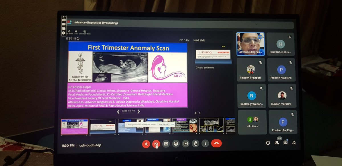 RajRegmiPradeep's tweet photo. Wonderful to moderate TUTH Webinar Series 1.0 on First Trimester Scan by Krishna Gopal... https://t.co/RvERSkzOjV