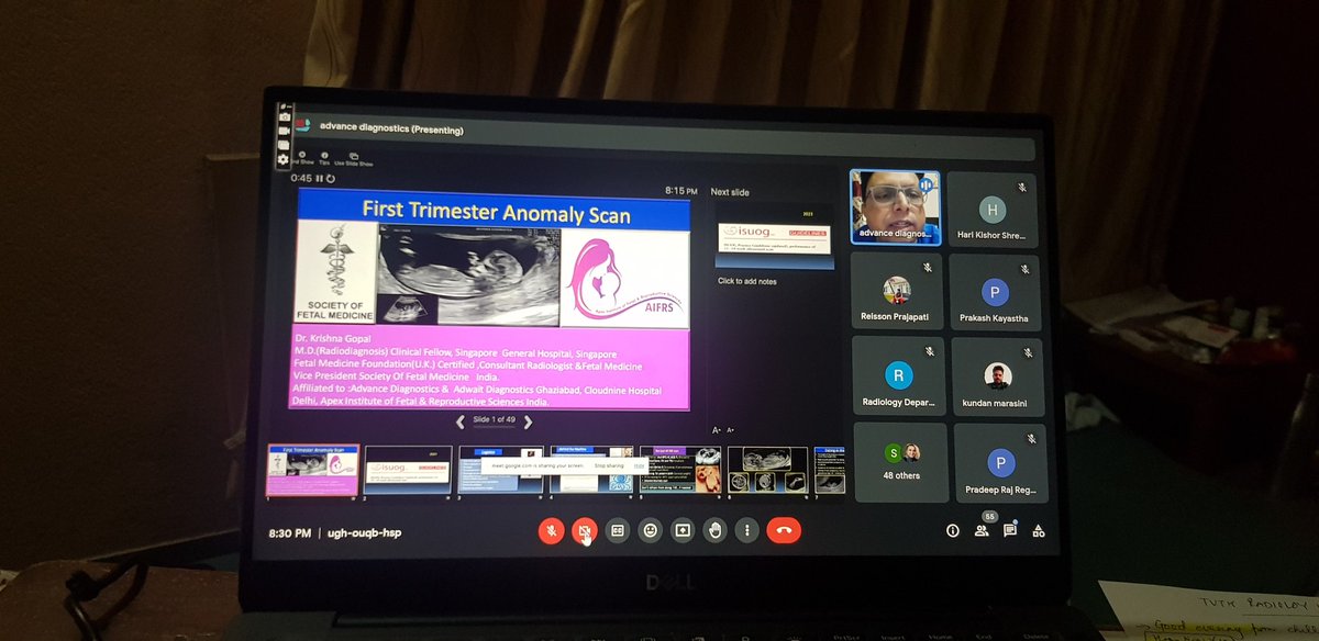 RajRegmiPradeep's tweet photo. Wonderful to moderate TUTH Webinar Series 1.0 on First Trimester Scan by Krishna Gopal... https://t.co/RvERSkzOjV