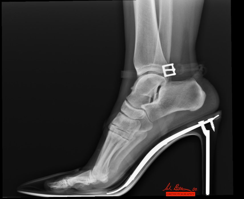 Adam Bitterman, DO, FAAOS tweet media