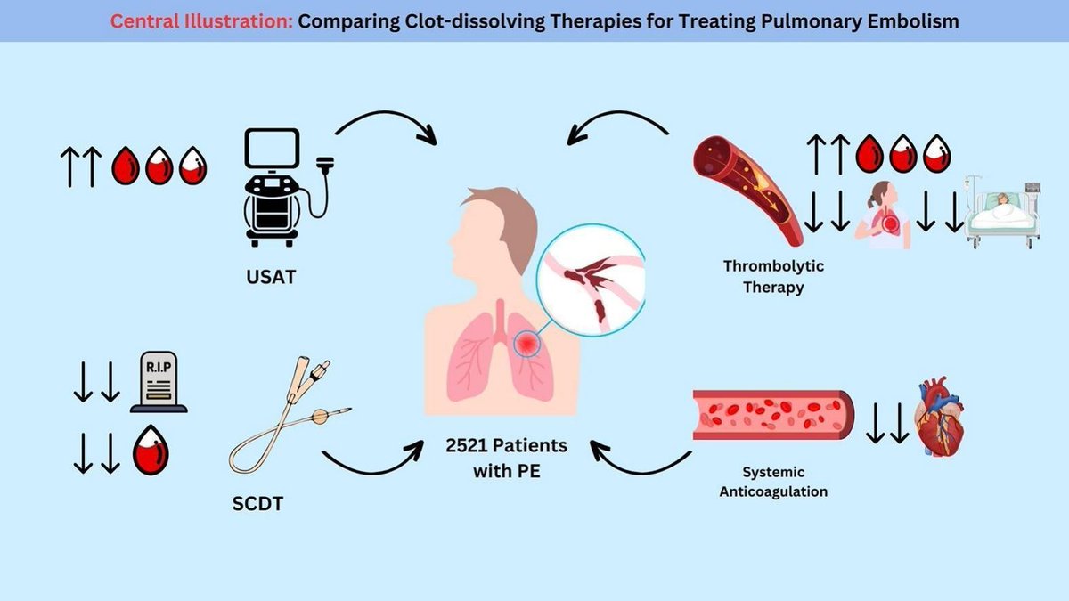 Just accepted in <a href="/CRMjournal/">CRMjournal</a>+@ELS_Cardiology!

Safety and efficacy of clot-dissolving therapies for submassive #PE: A network meta-analysis of #RCTs by Hussam Al Hennawi et al.

clinicalkey.com/#!/content/pla…
