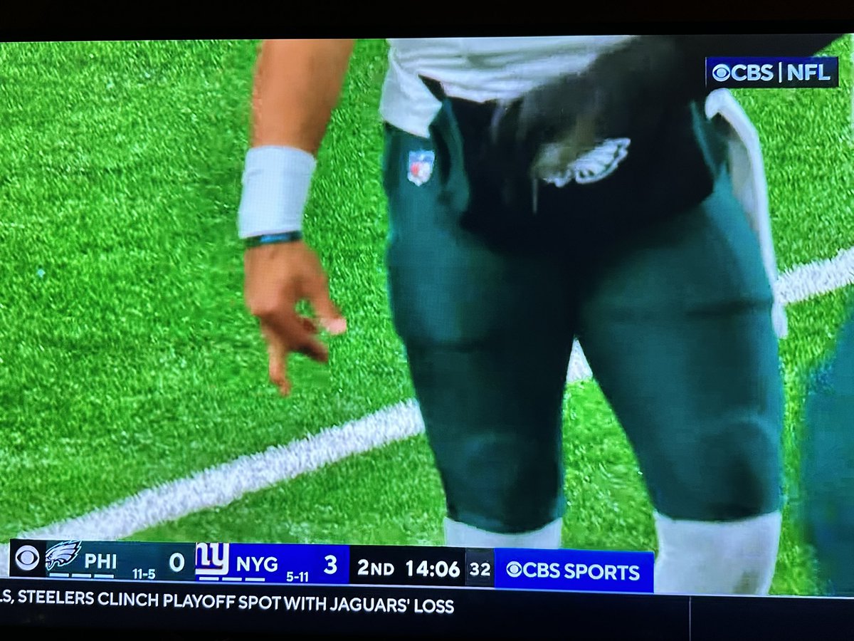 PHLEaglesNation's tweet photo. Jalen’s finger. 😬 https://t.co/wnPvb3h3sr