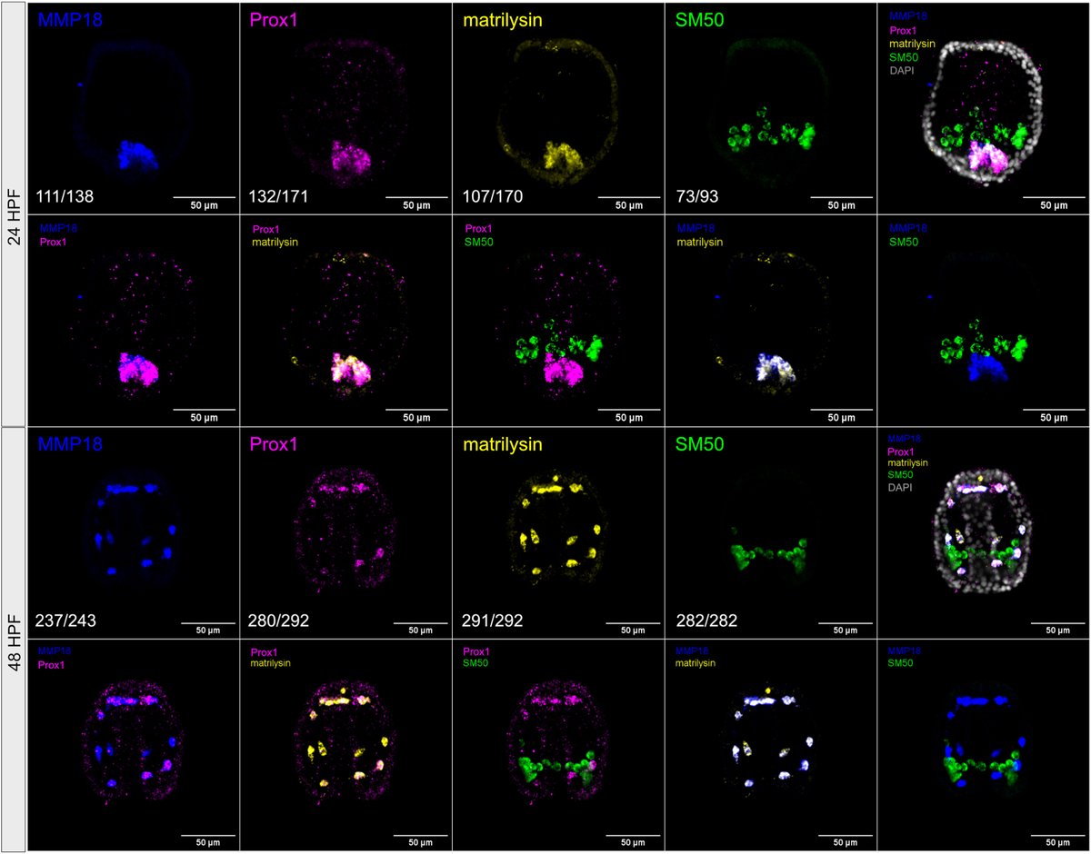 Developmental Biology (@dev_bio_journal) on Twitter photo #DBfeature #SeaUrchin
Solute carrier (SLC) expression reveals skeletogenic cell diversity
by Yoon Lee, Amro Hamdoun et al <a href="/Hamdounlab/">Amro Hamdoun</a>
sciencedirect.com/science/articlโฆ #DBfeature #SeaUrchin
Solute carrier (SLC) expression reveals skeletogenic cell diversity
by Yoon Lee, Amro Hamdoun et al <a href="/Hamdounlab/">Amro Hamdoun</a>
sciencedirect.com/science/articlโฆ