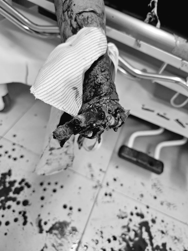 pixel_onlines's tweet photo. 19:30 Aproximadamente en #Daule, sujeto que intento detonar un artefacto explosivo contra el centro comercial Multicentro, le explota en las manos.
Quedaron destrozadas sus manos y con varias heridas por las esquirlas en el resto de su cuerpo, se encuentra en casa asistencial 
📷 Cortesía