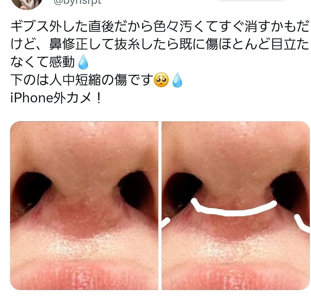 8yJvx38's tweet photo. あけましておめでとうございます

《2024年ご飯女の虚言予言1⃣》
元���に盗撮されていた→流出するかも…→自演垢から自分で流出

この流れは過去に4回やっているので今回もこのパターンがあるのではと思います😊

お年玉と言ってはなんですが3枚目は1枚使っている可哀想な証明写真、4枚目は鼻です。 https://t.co/wIaORJByJ6