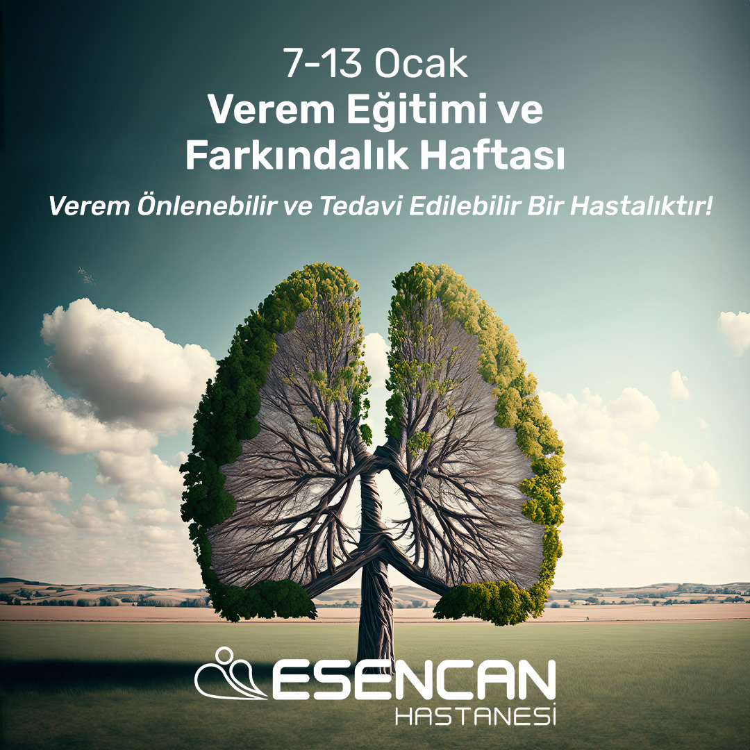 7-13 Ocak Verem Eğitimi ve Farkındalık Haftası

Verem Önlenebilir ve Tedavi Edilebilir Bir Hastalıktır 

#VeremEğitimiveFarkındalıkHaftası #Tüberküloz #VeremHastalığı #Verem #EsencanHastanesi