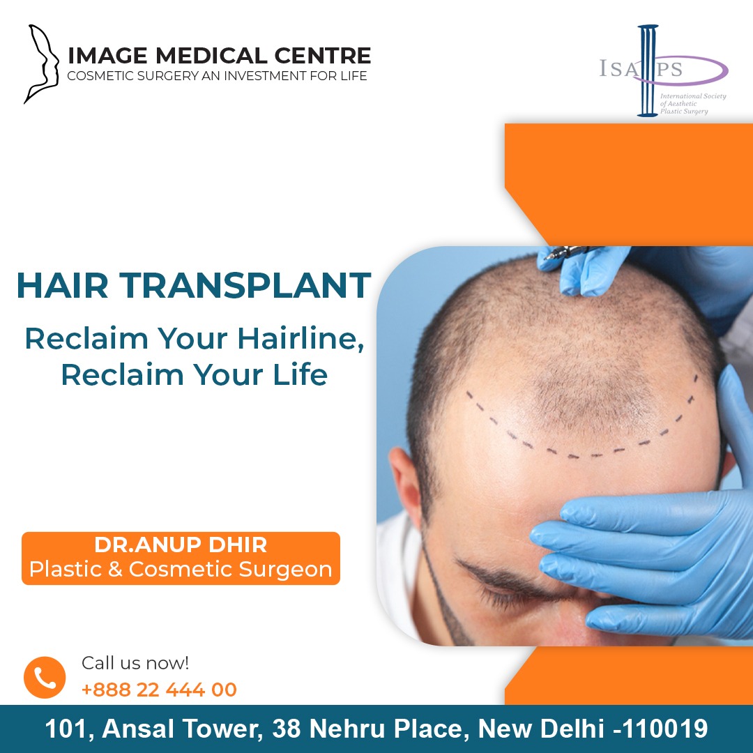 From hair loss to hair gain, Dr. Anup Dhir's passion for perfection shines through in every hair transplant procedure.

Visit: anupdhir.com/hair-transplan…
Call: 8882244400

#DrAnupDhir #CosmeticSurgery #HairTransplant
#HairLoss #HairLossTreatment #FUEHairTransplant
#FUTHairTransplant