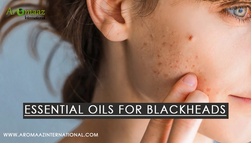 AromaazIntl's tweet image. Say goodbye to blackheads and hello to radiant, healthy skin with the magic of essential oils!

To learn more, click this link: aromaazinternational.com/blog/essential…

#EssentialOilMagic #ClearSkinJourney #NaturalSkincare #skincare #essentialoils