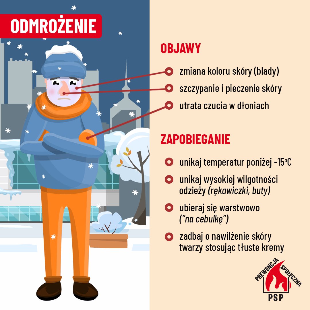 Zima pełną parą! 🥶 Odmrożenie to poważny problem, który może dotknąć każdego. Ubierajcie się warstwowo, noście czapki i rękawiczki. Jeśli poczujecie szczypanie i pieczenie, oraz Wasza skóra przyjmie blady kolor – to mogą być objawy odmrożenia! Nie bagatelizujcie tego stanu!☃️🌨