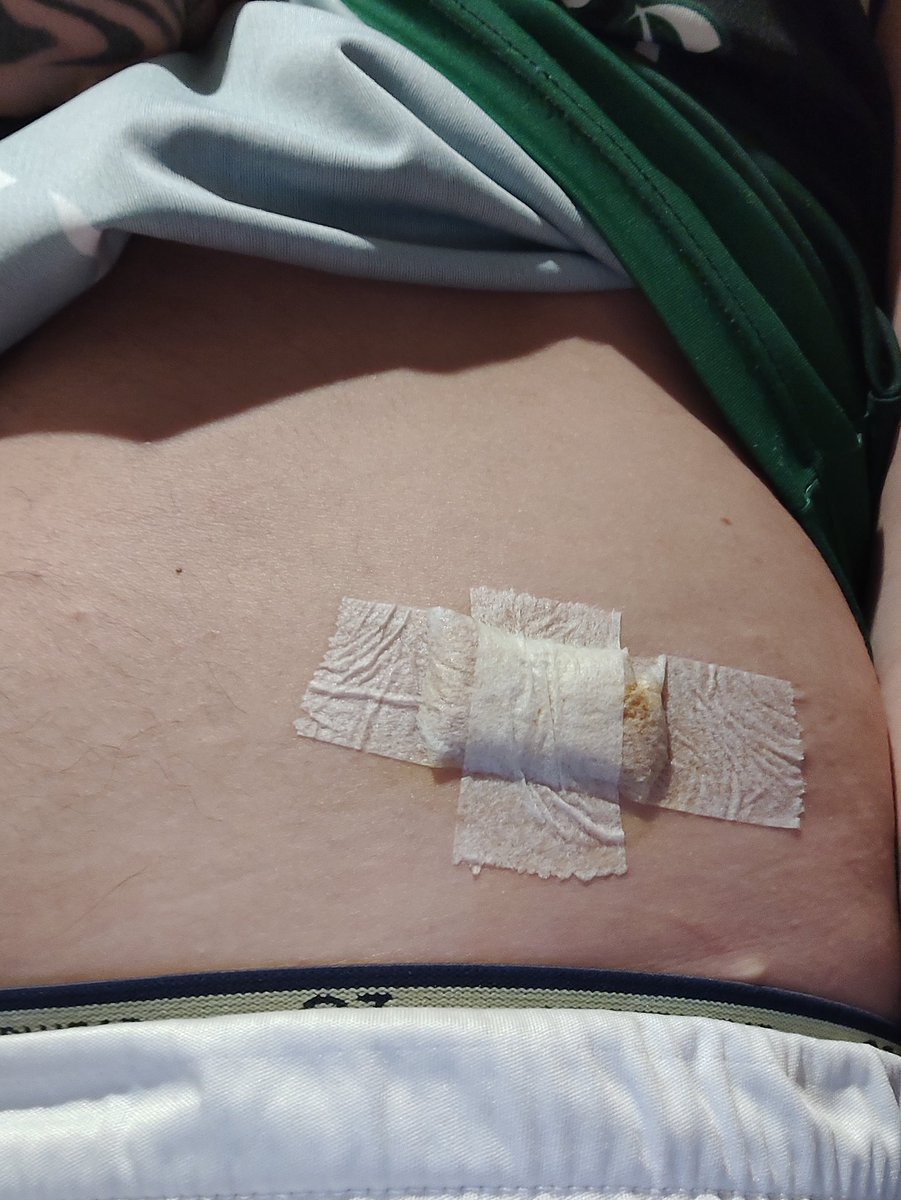 La puñalada que le pegaron a esta chica iba para mi.
A raíz de una discusión por un supuesto empujón,  a este hijo de puta se le ocurrió apuñalarme.  Tuve la suerte de que no me diera de lleno y me haga un corte leve, pero la peor parte se la llevo Chechu, que nada tenia que ver