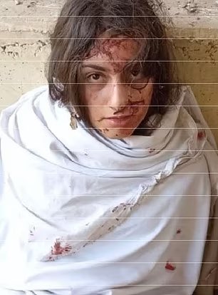 OliLondonTV's tweet image. This is 19 year old Karina Ariev. 

Before and After Hamas captivity. 

She has been held hostage since Oct 7th. 

When Palestinian activists try to claim Hamas’ treat hostages well, show them what they did to this young woman.