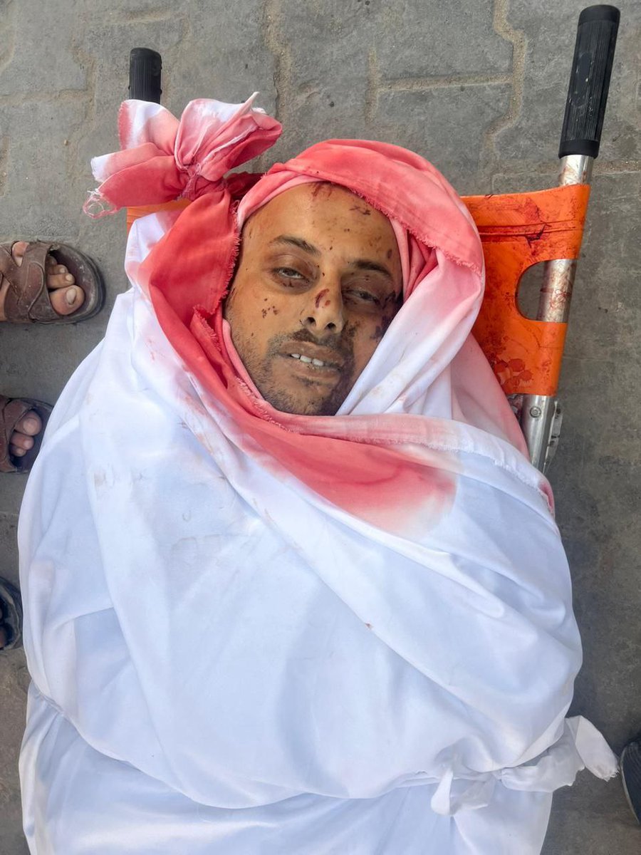 BREAKING | Photojournalist with the media office of the Ministry of Internal Affairs Muhammad Abu Misbah was killed after an Israeli airstrike on the Zuhd family home in Jabaliya