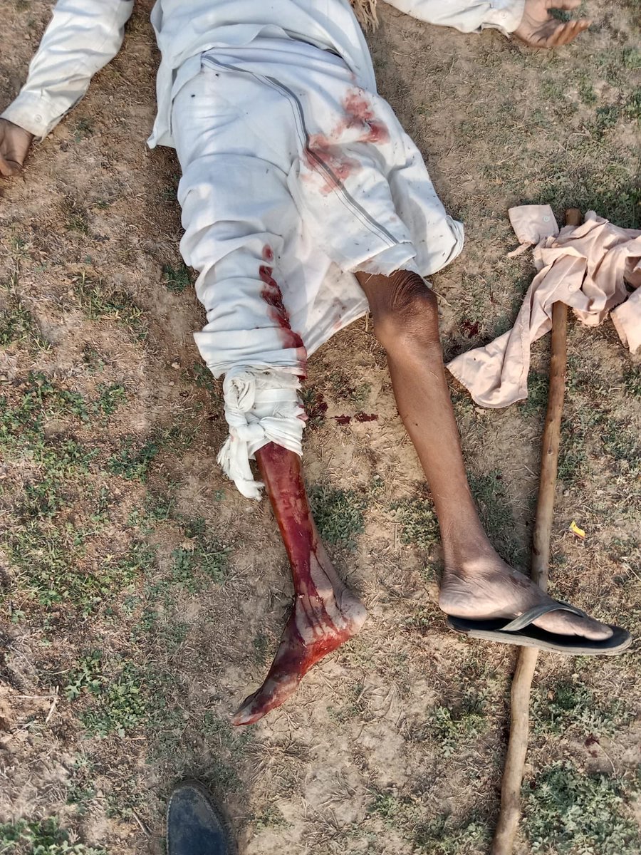 राजस्थान में जंगलराज नहीं हो रहा खत्म.बूँदी जिले के ख्यावता गाँव में बैरवा समाज की घर में अकेली बच्ची के साथ जुगराज गुर्जर ने जबरन बलात्कार किया घर वालों ने विरोध किया तो अपने साथियों के साथ परिवार पर कुलाड़ी से हमलाकर दिया।अभी तक fir भी दर्ज नहीं किया गया है।