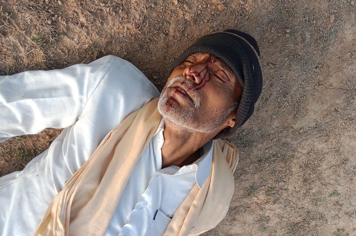 लठैतों का जातीय आतंक!

बूंदी, राजस्थान में लड़की से छेड़छाड़ का विरोध करने पर जुगराज गुर्जर व उसके परिजनों ने एक SC परिवार के महिला सहित सभी सदस्यों पर नृशंस हमला किया। 

कांग्रेस की तरह बीजेपी भी जातिगत आतंक पर चुप्पी साधे हुई है। SC समुदाय का जीना दूभर हो गया है।