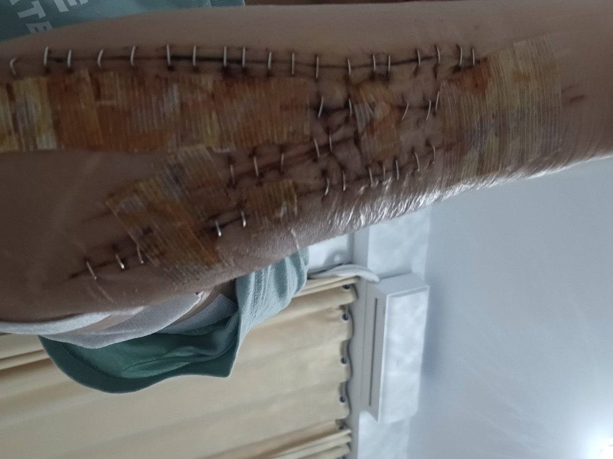 第一次用釘皮機💀酷