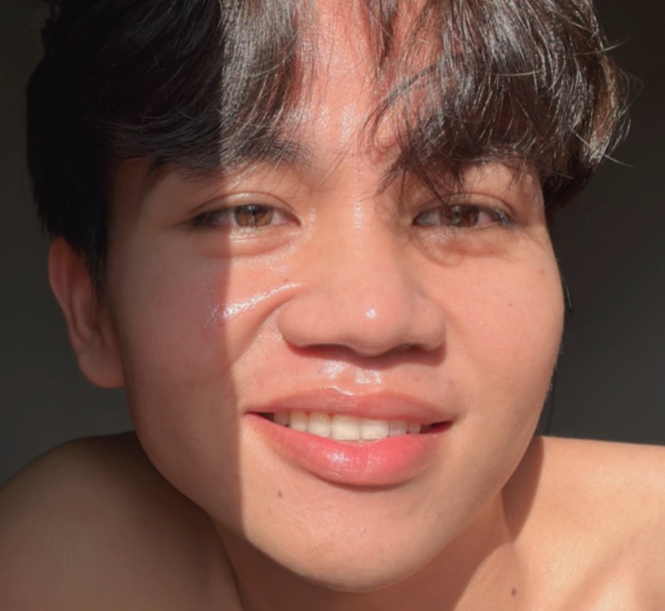 JsQuinlan29's tweet photo. PART 1

I'm not single!
Sy ada on-off relationship with acne🥲🥰

Lemme share drpd bnyk2 products yang sy prnh try... These r some yng berkesan for me (ni my opinion n experience ya)😌 https://t.co/DPV66iblbQ