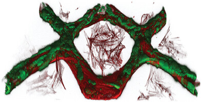 🚀 Exciting News! 📷 Thrilled to announce our material "HYDROBIO INX U200" available through our partner @upnano_gmbh is featured in a groundbreaking publication in Wiley Advanced Materials Technologies!  Congrats to the researchers of @UU_University!

onlinelibrary.wiley.com/doi/full/10.10…