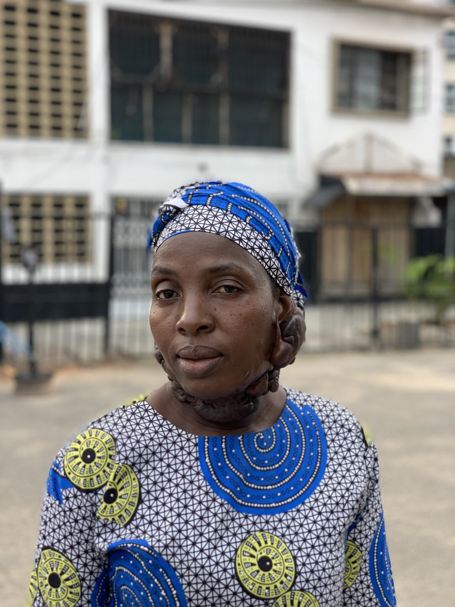 My mum have this and I’m not ashamed of her wherever we go together….Tho some children and even adults gets to look her somehow whenever we’re out but my mum doesn’t get bothered about that. I pray God bless me to take care of her 🤲😩

She’s a real Gold to me ❤️💯