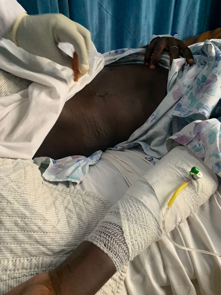 In the blink of an eye, hate can take away a life, but I refuse to give up on love. I am coming back stronger than ever, and I need your support to help me in my fight for justice. Please consider donating to my medical support  at givebutter.com/steven-kabuye as I strive for another