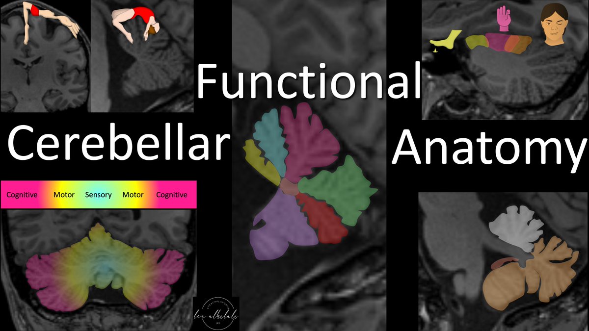 1/Your baby’s all grown up!

Cerebellum may mean “little cerebrum” but its jobs are anything but little

How well do YOU know cerebellar anatomy?

Do you just say “cerebellar hemisphere” &amp; hope nobody asks?

Here’s a thread to teach you the key cerebellar functional anatomy!