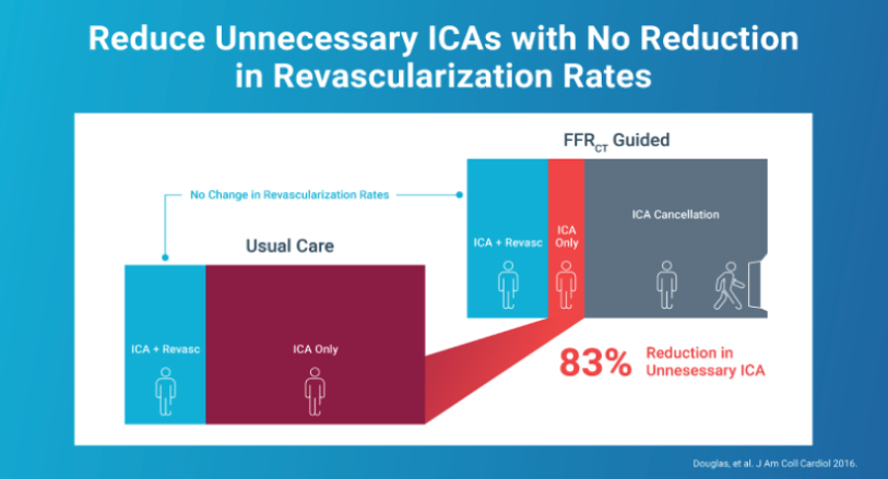 Heartflow's tweet photo. #DYK The #HeartFlowAnalysis helps docs determine which patients need to go to the cath lab for an invasive assessment while appropriately avoiding the cath lab for patients without blood-flow limiting disease. Learn more about our tech: https://t.co/2E0lx0e4qr. #FFRct #yesCCT #AI https://t.co/P93jpqV2tQ