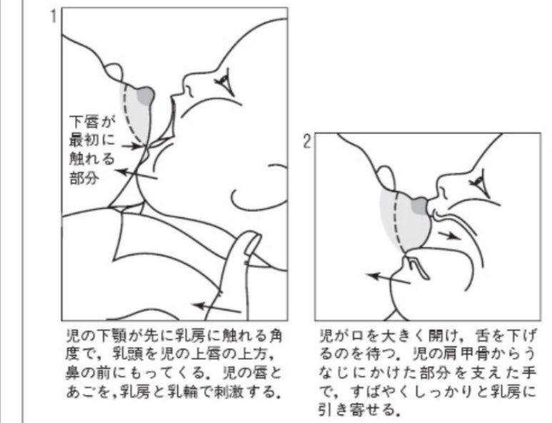 コレ2人目の時に助産師さんに教えて貰ったけどマジで目から鱗だったよな…

乳首はまっすぐ入れるんじゃなくて、乳首の先端を上向けて赤ちゃんの口に押し込むんよ

そうすることで新生児の時も乳首切れたりせずスムーズにゴクゴクいってくれる

プレママさんや産後ママなど母乳育児やってる人に届け〜 