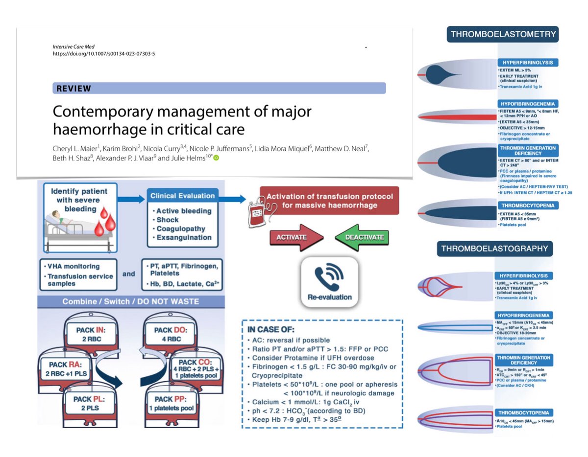 Major haemorrhage in critical care
🩸pathophysiology of hemorrhagic coagulopathies: trauma, postpartum, chronic liver disease, DIC, uremia, anticoagulation
🔍diagnosis &amp; evaluation
📃protocols
🩸management post bleeding &amp; massive transfusion
🤔 &amp; more
🔓bit.ly/3tNpTLt