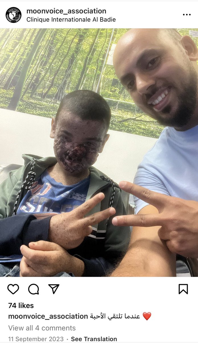 O_Rob1nson's tweet photo. This image of a child in hospital circulating on X has nothing to do with Israel.

The video was filmed in Morocco and posted by the founder of a local charity that helps children with XP - a rare genetic condition that causes extreme sensitivity to sunlight. https://t.co/BQ3hCxLyB4