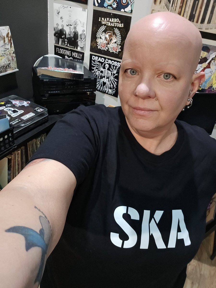 Reppin Ska Tinz today. 🏁
Have a wonderful day all. @CoolieRanx #skatinz #Ska #Alopecia #alopeciaareata #alopeciaawareness