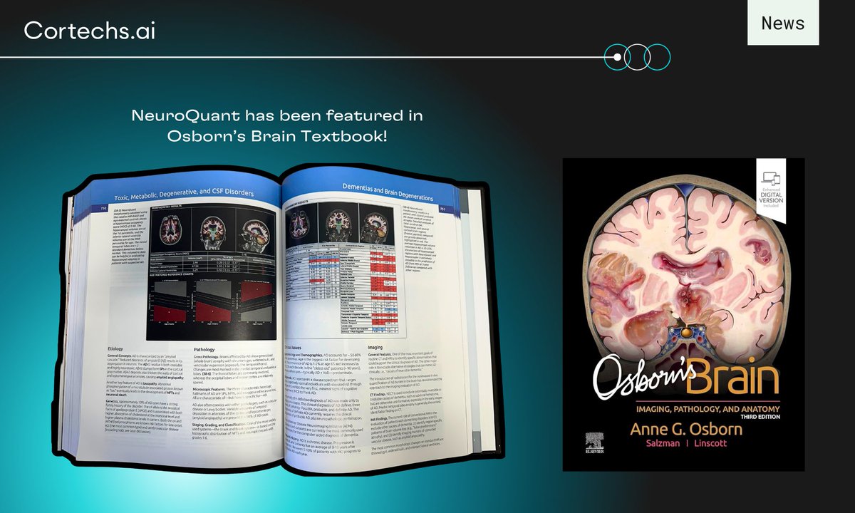 Cortechs_ai's tweet image. #NeuroQuant has been featured in Osborn&apos;s Brain, a cornerstone text in the world of neuroradiology! This recognition is not just an honor - it&apos;s a testament to the groundbreaking work our team has been doing in the field of volumetric quantification. #radiology 🧠📚🎊
