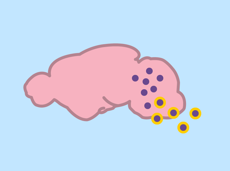 broadinstitute's tweet photo. Prime editing can correct most known disease-causing mutations, and now has a new vehicle to deliver its machinery in mice. The @davidrliu lab has engineered virus-like particles that deliver prime editors efficiently enough to have a therapeutic benefit. https://t.co/FQ5tNd3pta https://t.co/KF7auTODRg