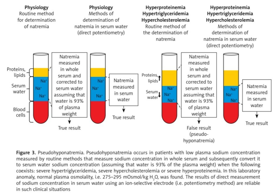 ZHeart11768530's tweet photo. Hyponatremia in patients with arterial hypertension: pathophysiology and Management #2023State-of-the-Art #Review #openaccess 

https://t.co/couQI7FOM9
 #CardioEd #CardioTwitter #MedEd #FOAMed #CardioEd #Cardiology https://t.co/wVGdZ2uKRj