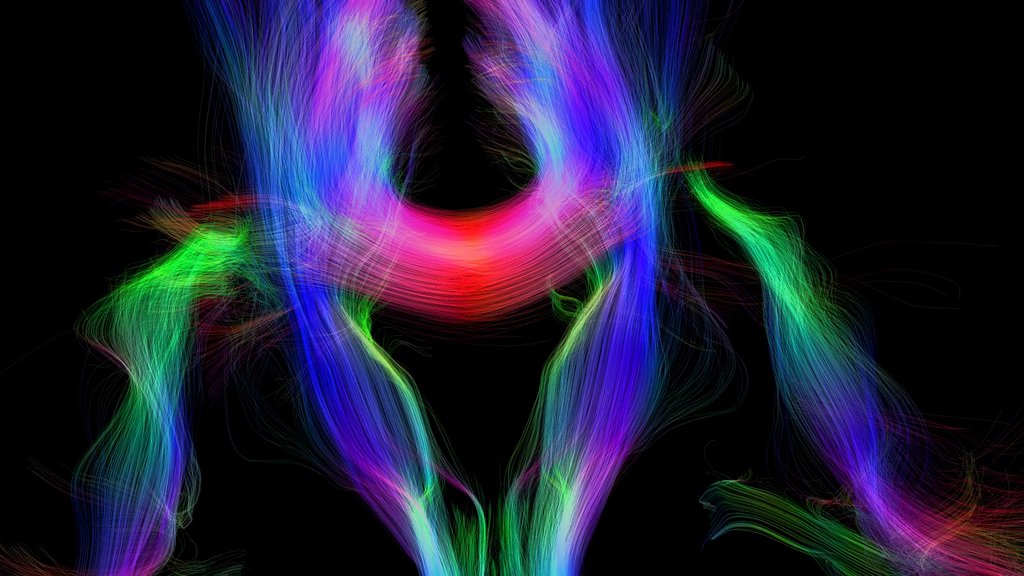 Alfred Anwander @AlfredAnwander.bsky.social tweet media