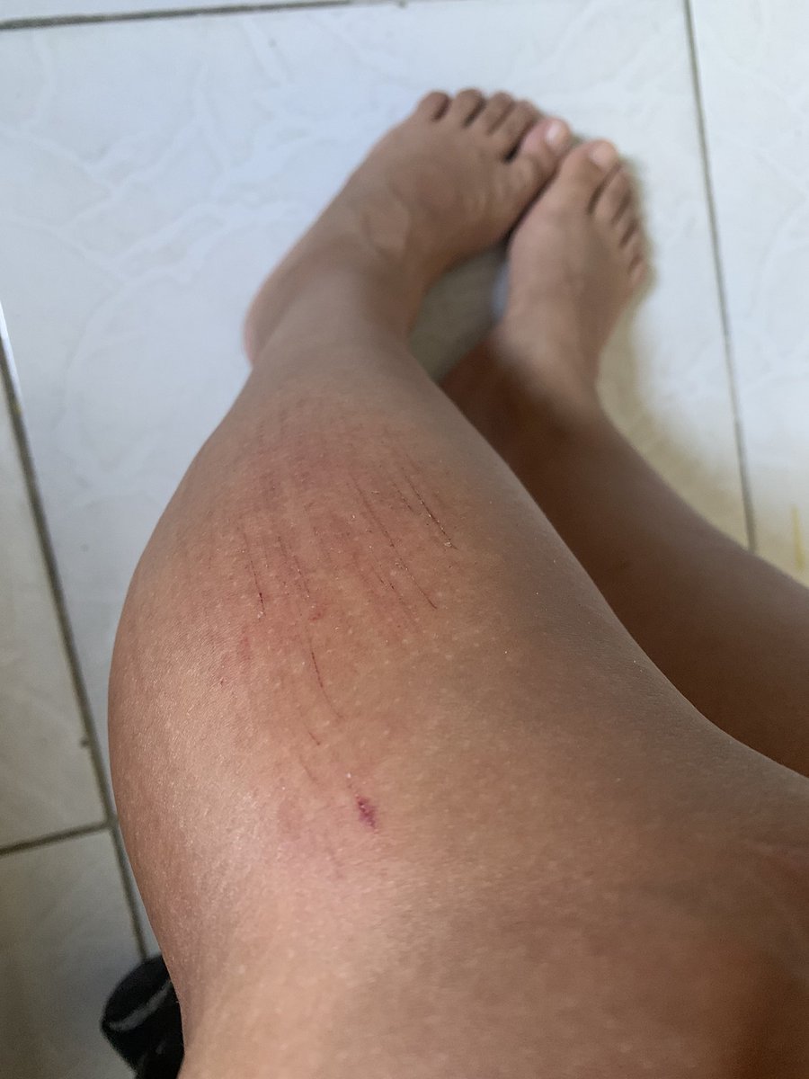 Hoje fui batizada no asfalto.
Não recomendo 🥲