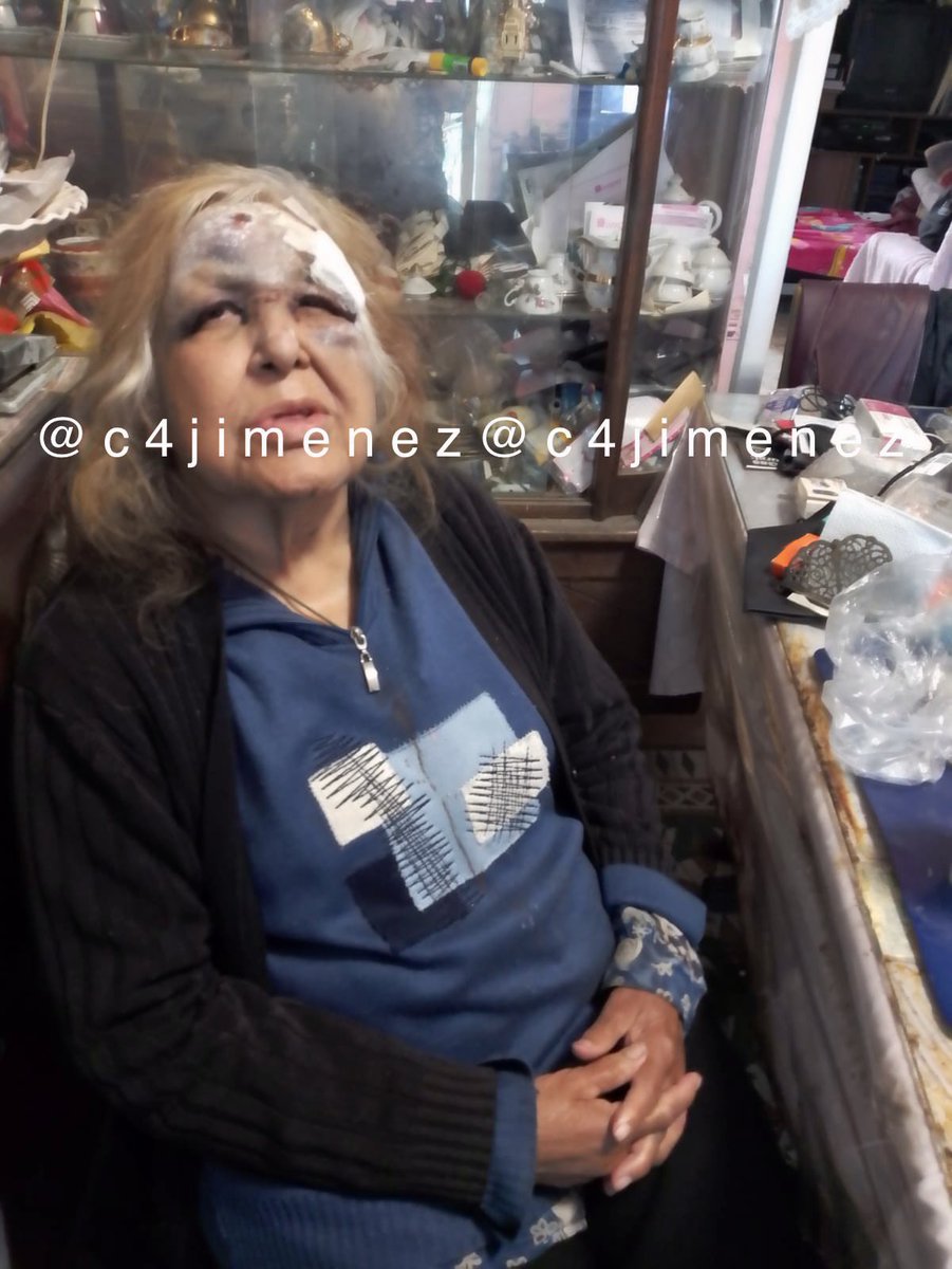 c4jimenez's tweet photo. MURIERON ESPERANDO AYUDA d @FiscaliaCDMX
-Blanca acusó q su suegro iba a matarla
-Maria denunció q iban a asesinarla
-La sobrina d Irma acusó q su hijo la violentaba
Hoy todas están MUERTAS
Pero los diputados @MorenaCiudadMex arengan q @ErnestinaGodoy_ siempre ve por las víctimas https://t.co/DzETLs8h7N