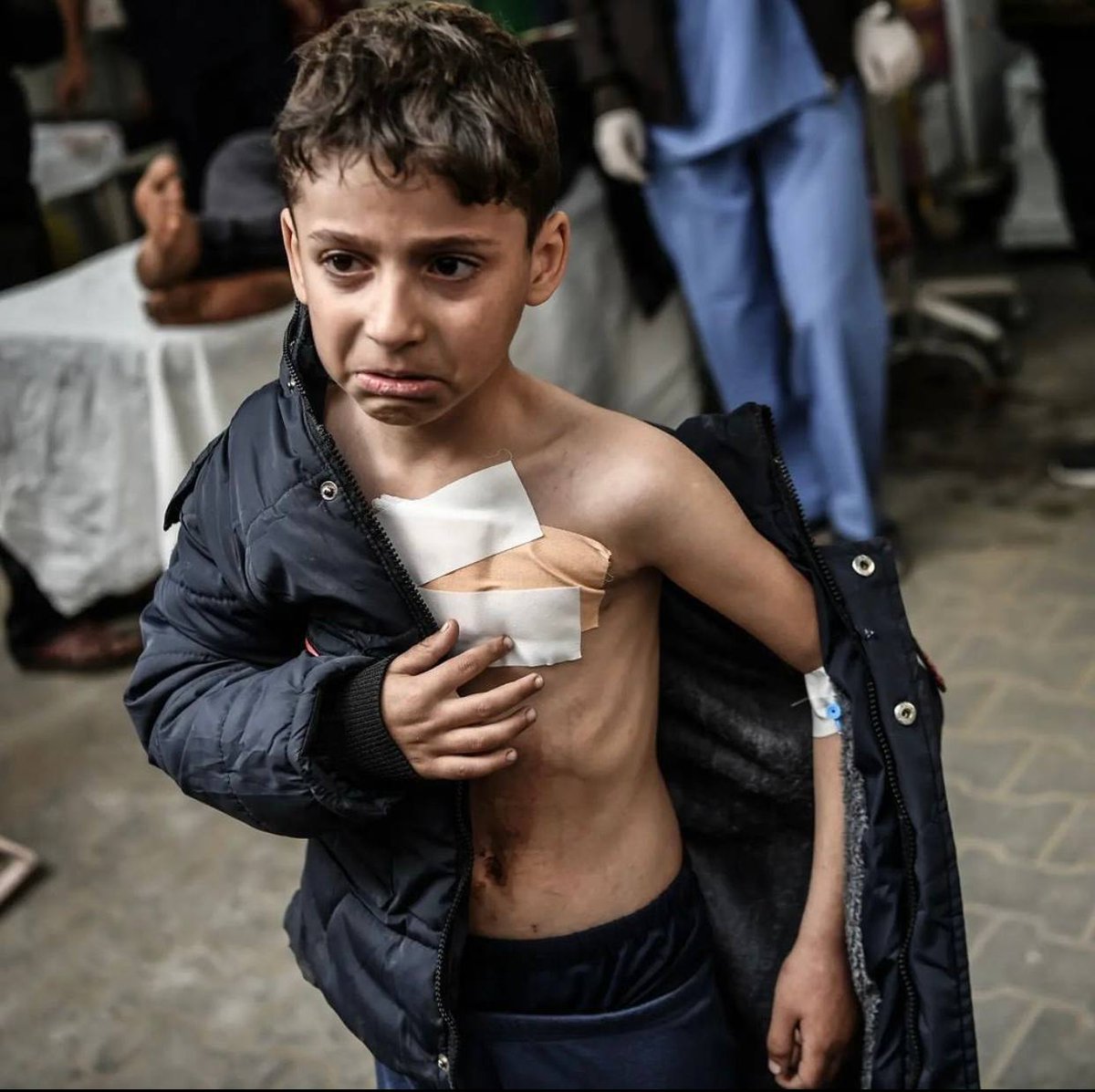 An injured child receives treatment in the Kuwaiti Hospital after surviving an Israeli airstrike in Rafah