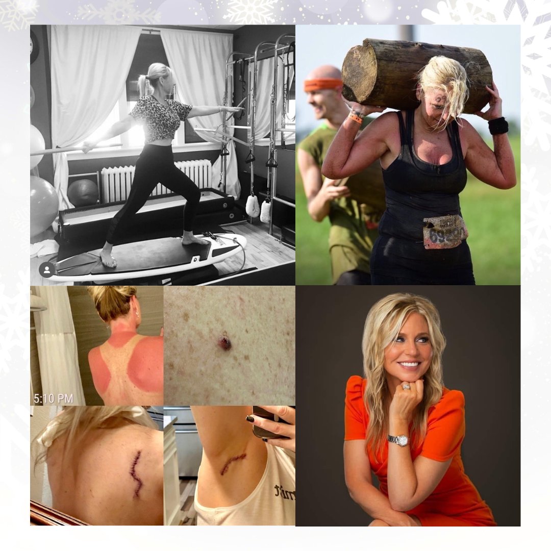 Only a few days left to sign up and join melanoma thriver, <a href="/JodyVore/">JodyGirl</a>, at her upcoming fundraiser at <a href="/clubpilates/">Club Pilates</a> of Perrysburg, OH on January 14th! Your participation will not only contribute to Jody’s melanoma journey but will also be a meaningful step towards raising awareness