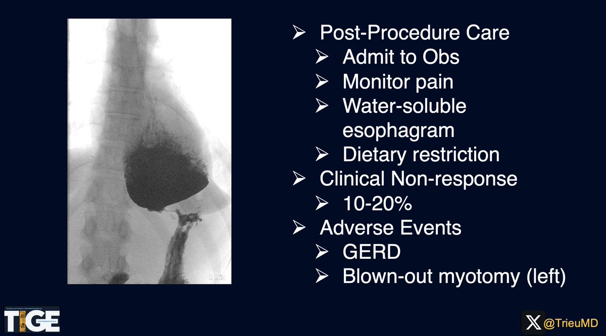 Judy Trieu, MD, MPH (@trieumd) on Twitter photo 📣<a href="/AGA_TIGE/">TIGE</a> WEEKLY HIGHLIGHT📣
📰 <a href="/ArvindRenga/">Arvind Rengarajan, MD</a> & <a href="/gastrowala/">Aziz Aadam</a> review the role of POEM in achalasia and non-achalasia esophageal motility disorders.
#WritingPoetry @WUGastro & <a href="/NM_IntEndo/">Northwestern Interventional Endoscopy</a>
🔎For more details: doi.org/10.1016/j.tige… 📣<a href="/AGA_TIGE/">TIGE</a> WEEKLY HIGHLIGHT📣
📰 <a href="/ArvindRenga/">Arvind Rengarajan, MD</a> & <a href="/gastrowala/">Aziz Aadam</a> review the role of POEM in achalasia and non-achalasia esophageal motility disorders.
#WritingPoetry @WUGastro & <a href="/NM_IntEndo/">Northwestern Interventional Endoscopy</a>
🔎For more details: doi.org/10.1016/j.tige…