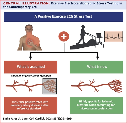In patients with angina with nonobstructive coronary arteries, ischemia on ECG stress testing (EST) was highly specific of underlying ischemic substrate. These findings challenge the traditional belief that EST has a high false positive rate jacc.org/doi/10.1016/j.… @JACCJournals