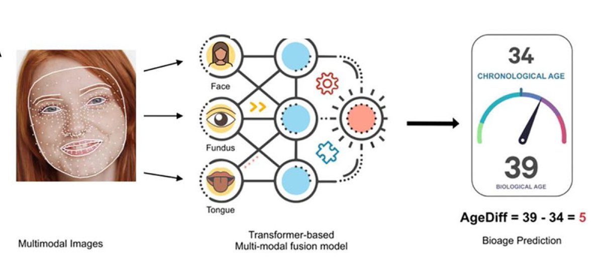 EricTopol's tweet photo. Non-invasive assessment of biological age.
Use of a transformer #AI multimodal model of images from the face, tongue and retina 
https://t.co/vzvDtoamxt 
"superior to biological age prediction models such as DNA methylation clock, transcriptome aging clocks and blood profiles" https://t.co/M3ggzIj0Y5