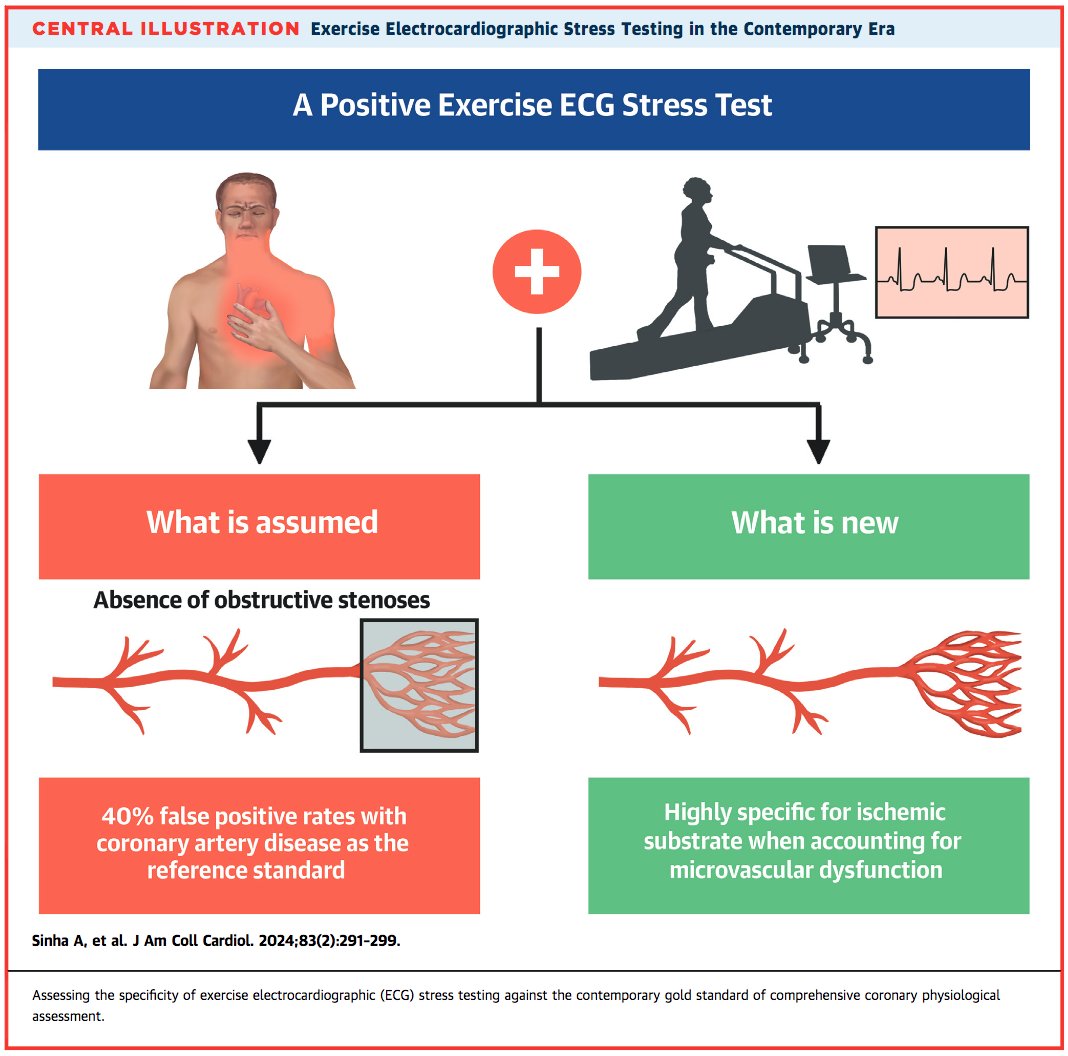 Diagnostic accuracy of ischemic ECG Stress testing to detect coronary microvascular dysfunction:

ECG had 100% specificity for detection of microvascular dysfunction (defined as CFR&lt;2.5 and/or Positive ACh challenge at invasive functional testing)

jacc.org/doi/10.1016/j.…