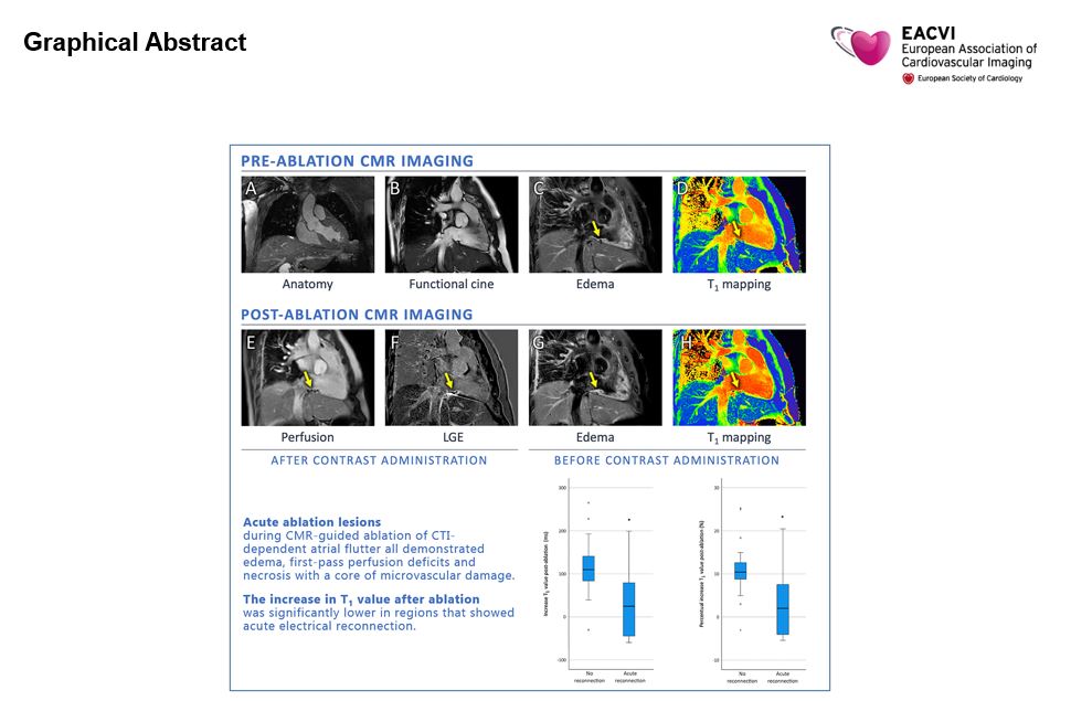 A new study on MRI-guided ablations has been published! Congratulations @MirandaBijvoet and the entire dedicated team involved in the study! bit.ly/47wNM7I #Epeeps #CardioTwitter
