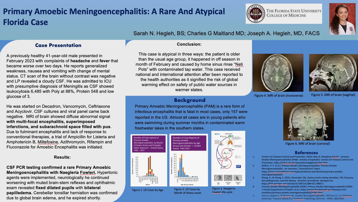 SHegleh's tweet photo. I was glad to present rare case of #PAM Primary #Amoebic Meningio #Encephalitis by Naegleria Fowleri. Oddities: Old Age, Winter, #PublicWater Contamination 🚫Swimming #Florida #GlobalWarming @FSNeuro #MedTwitter #MedicalStudent #AAOYO #Ophthalmology #Neurology @YoungMDConnect 🧠 https://t.co/KGX8d9FI19