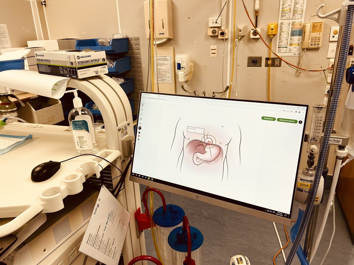 postscriptmed's tweet image. Gastroscopy with throat spray. Explanation of reflux oesophagitis and hiatus hernia immediately after procedure with print out provided. Happy and educated patient!