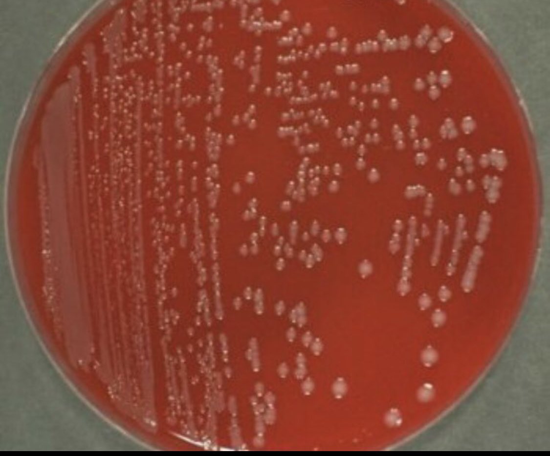 #idboardreview 30 MSM PLWH undetectable VL on ART, with bloody diarrhea. Attended a party 3 days ago (where had multiple sex partners condom less sex, ate sea food) some others who attended now sick. #idtwitter #idmeded #meded