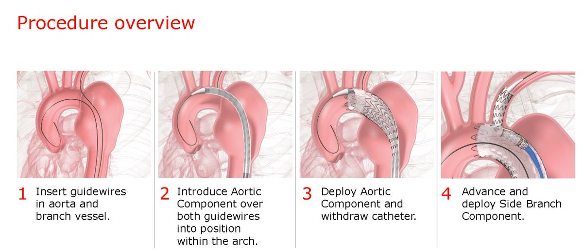Sabeen Dhand tweet media