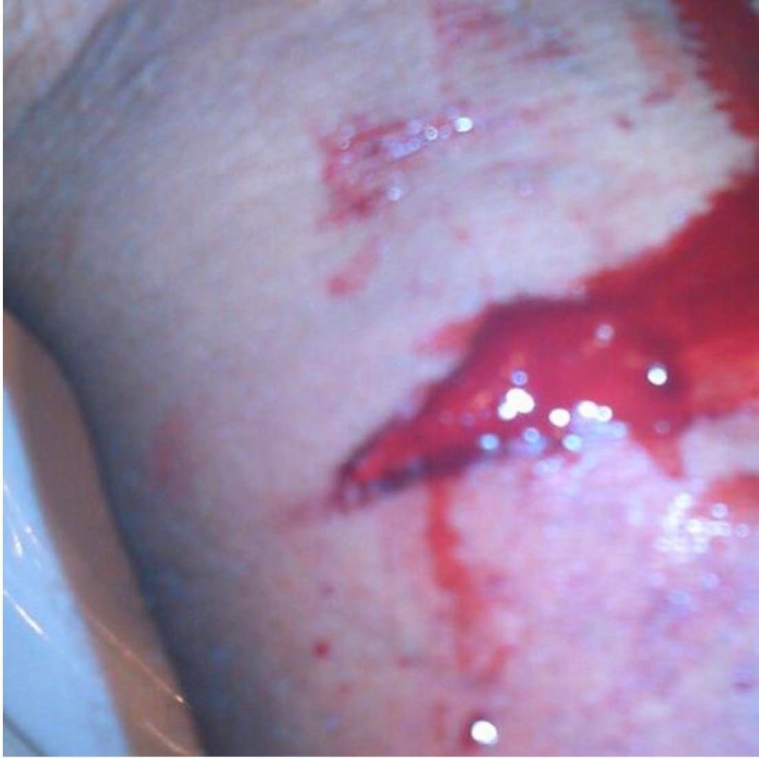 Ep 390! A wrestler, who almost made it to the top, but his personality set him back. He seemed to lose his mind, when he was released by WWE, but a year later, he really unravels. A sudden &amp; brutal murder, in front of the neighbors. Will he pay the price?
podcasts.apple.com/us/podcast/cri…