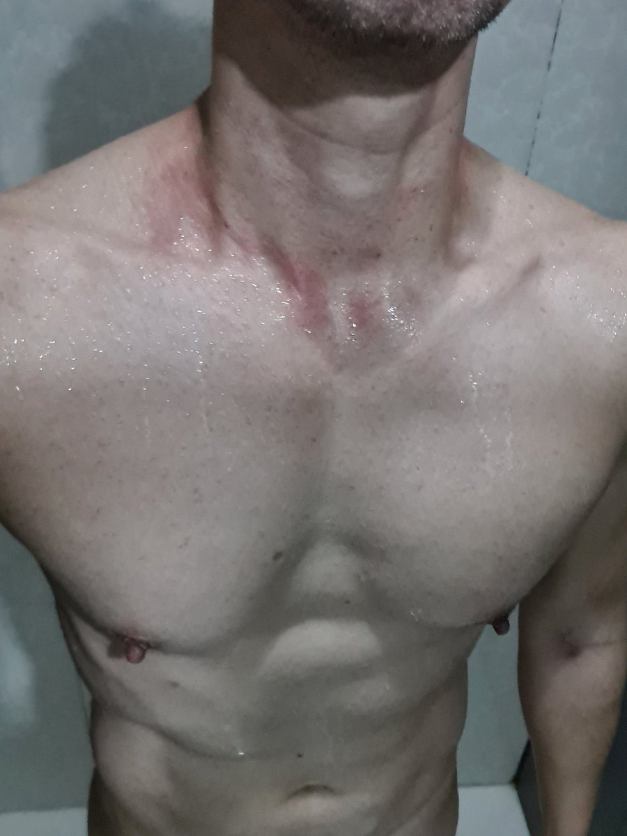pampdance1's tweet photo. คอแดง..แฟนไม่มี.. #คันอ่ะ 💥💥 ##mybody #chest #nipples #itchyneck #getred #malebody https://t.co/Ticd9OVOCj